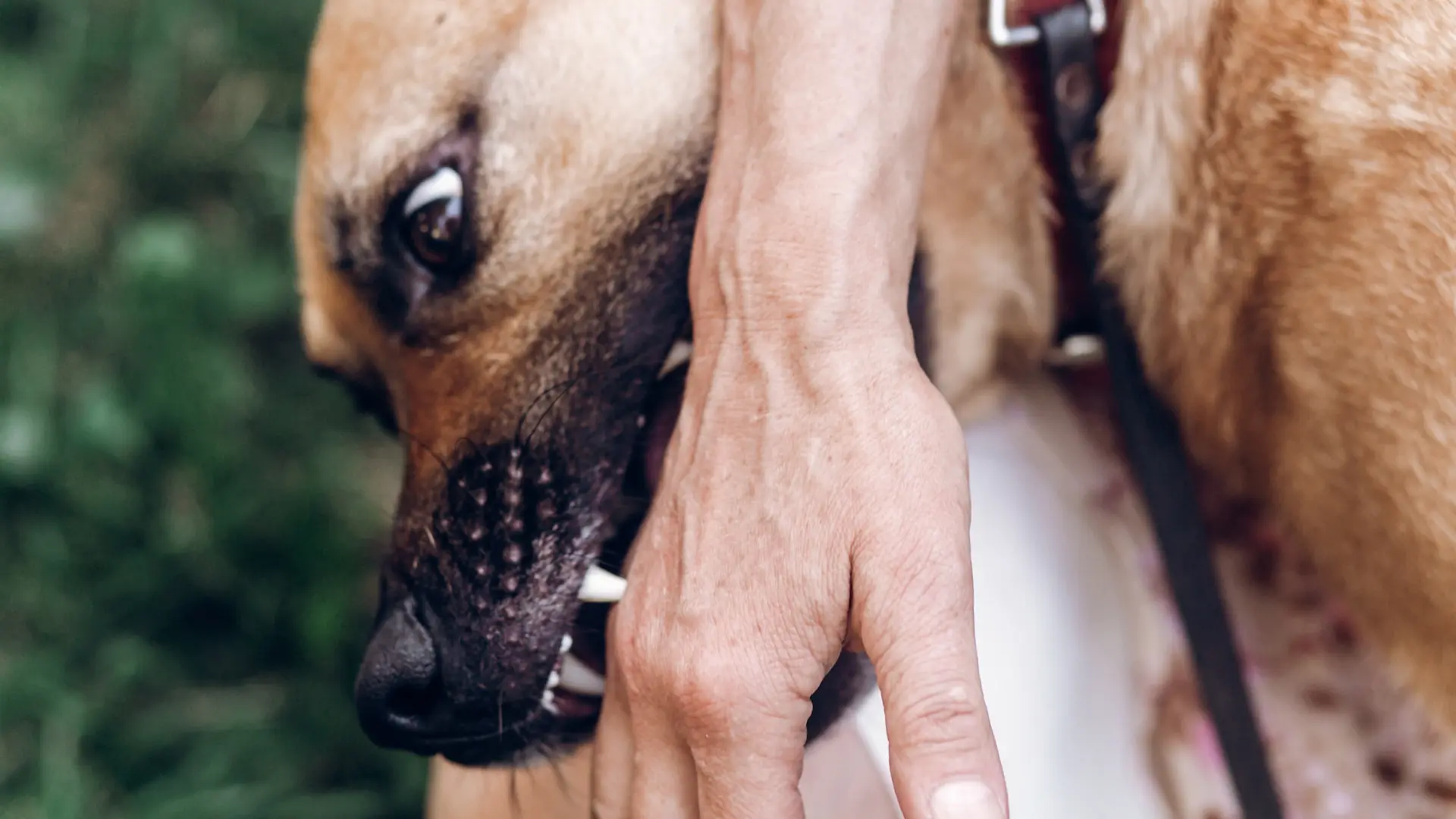 Michigan Strict Liability Dog Bite Laws: Your Rights & Compensation Options